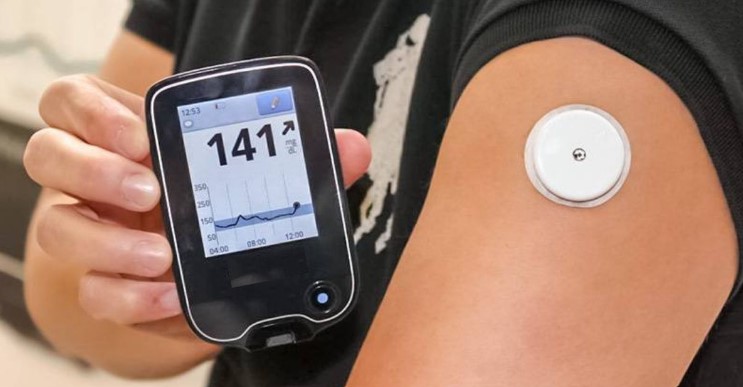 Figure 3 – An example of a continuous glucose monitoring device. We can see the sensor attached to the patient’s skin under which a needle lies. Data are transmitted wirelessly (Pros & Cons of Continuous Glucose Monitors for Young Children with Type 1 Diabetes, 2019).